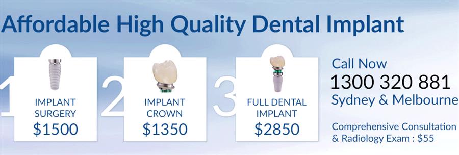 dental implant professionals