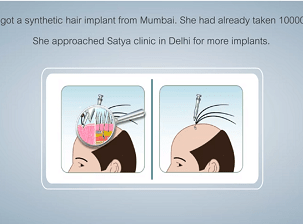 satya hair clinic