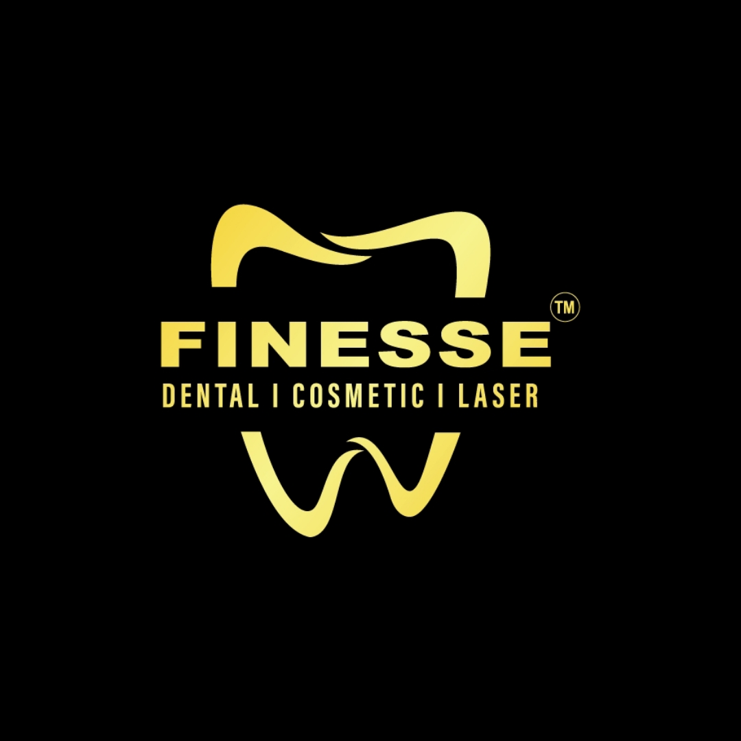 finesse dental clinic | dental in mohali punjab