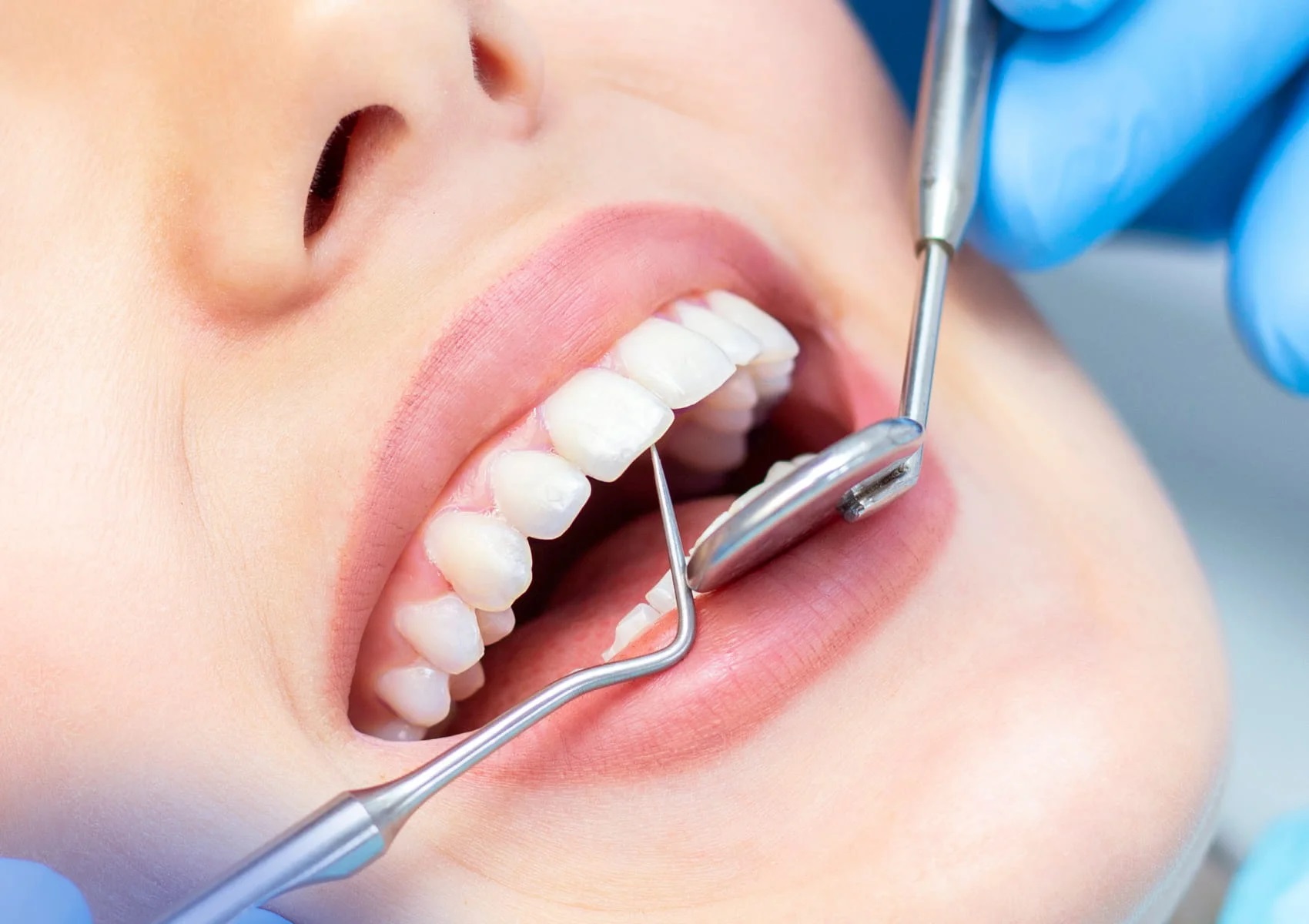 32 smile concepts - dental clinic vijayawada | dentists in vijayawada