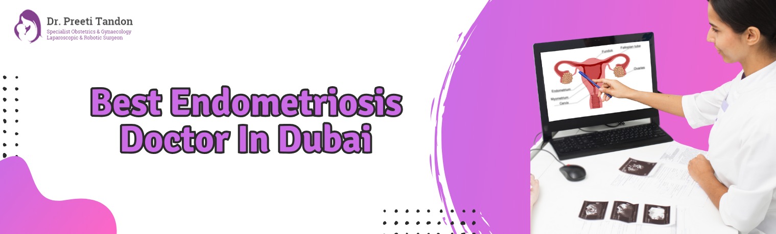 best endometriosis doctor in dubai | health care in dubai