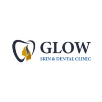 glow skin & dental clinic | dermatology | skin doctor | rct | dental implant | tooth extraction | dental in lalitpur