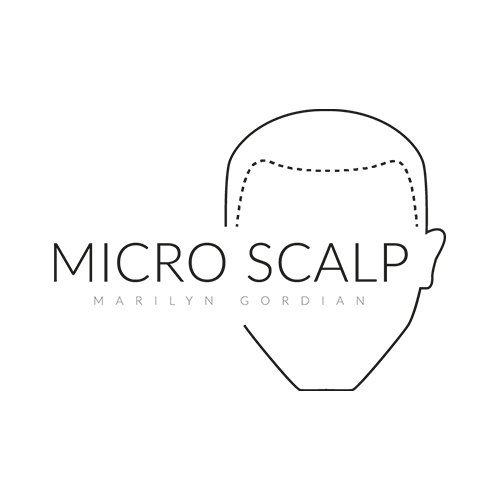 micro scalp marilyn | micropigmentation capillaire | tatouage cheveux | tattoo in terrebonne