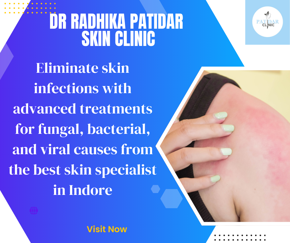 dr radhika patidar skin clinic | dermatologists in indore